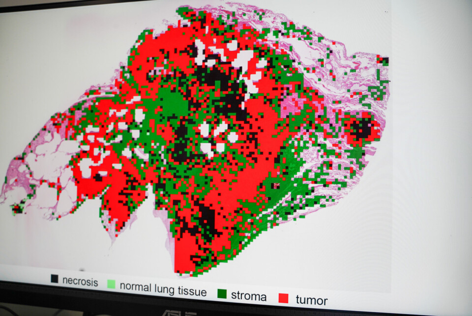 KI-bilde av lungevev