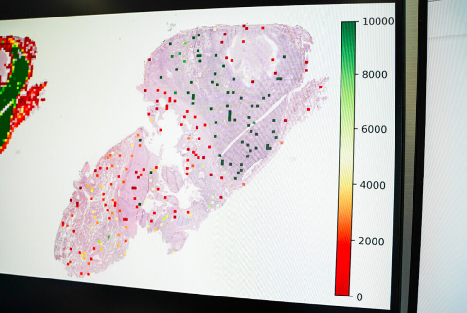 KI-bilde av lungevev