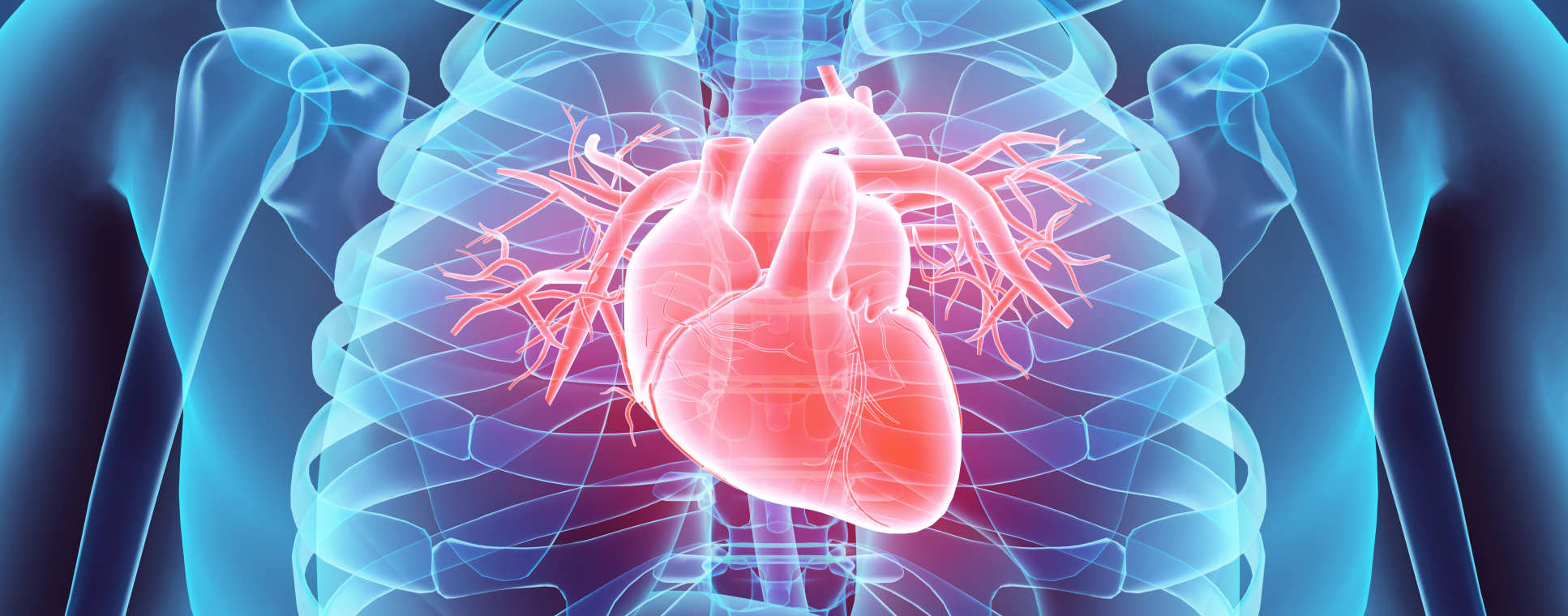 Infarto: O que não te explicaram ?
