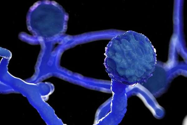 Mucormicose: Infecções fúngicas agressivas estão ocorrendo em pacientes com COVID19
