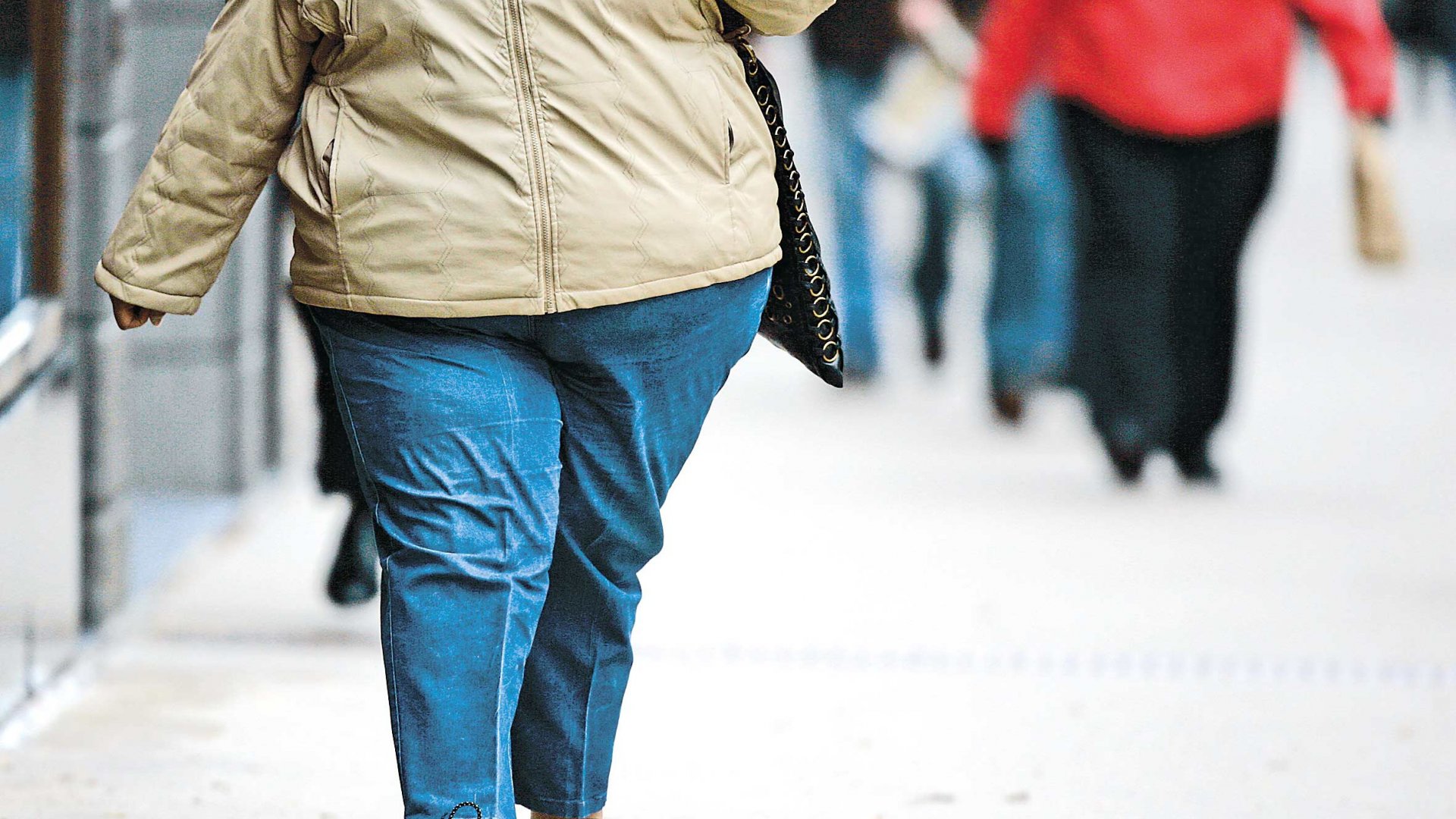 Obesidade: Uma doença crônica