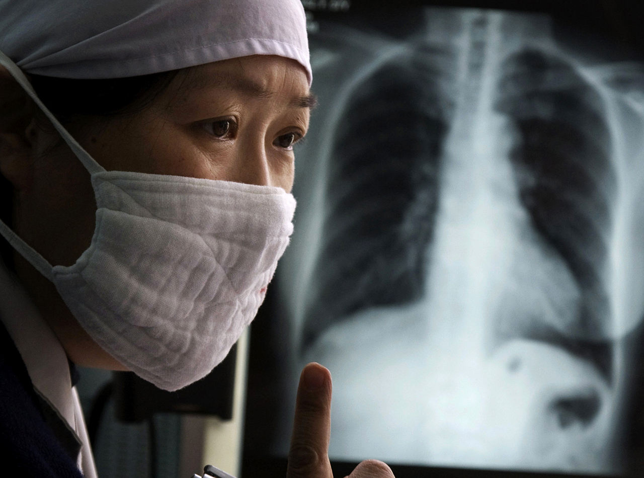 Dia 24 de março é celebrado o dia mundial da tuberculose