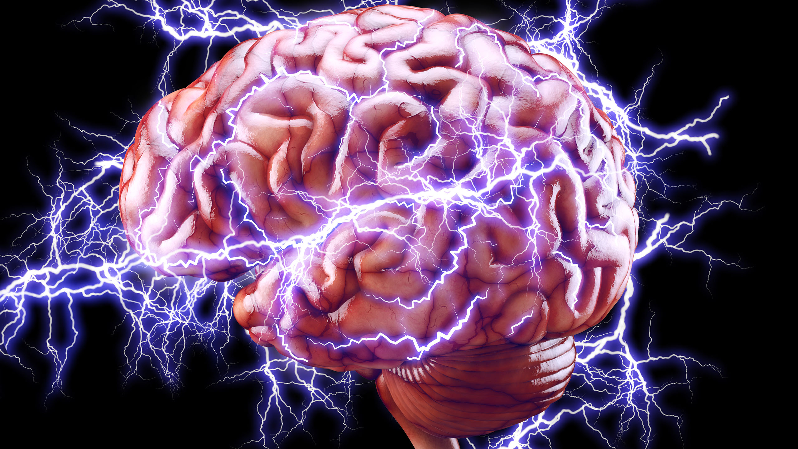 Março Roxo: Conscientização a Epilepsia