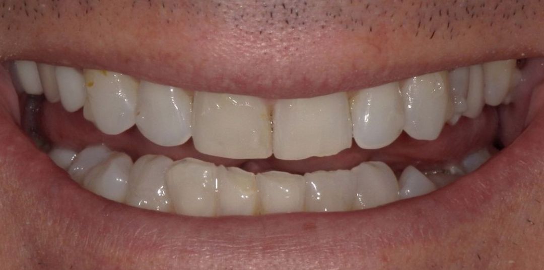 before and after treatment