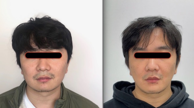 Before & After