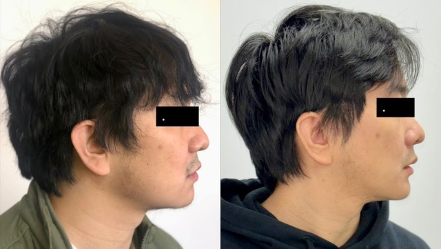 Before & After