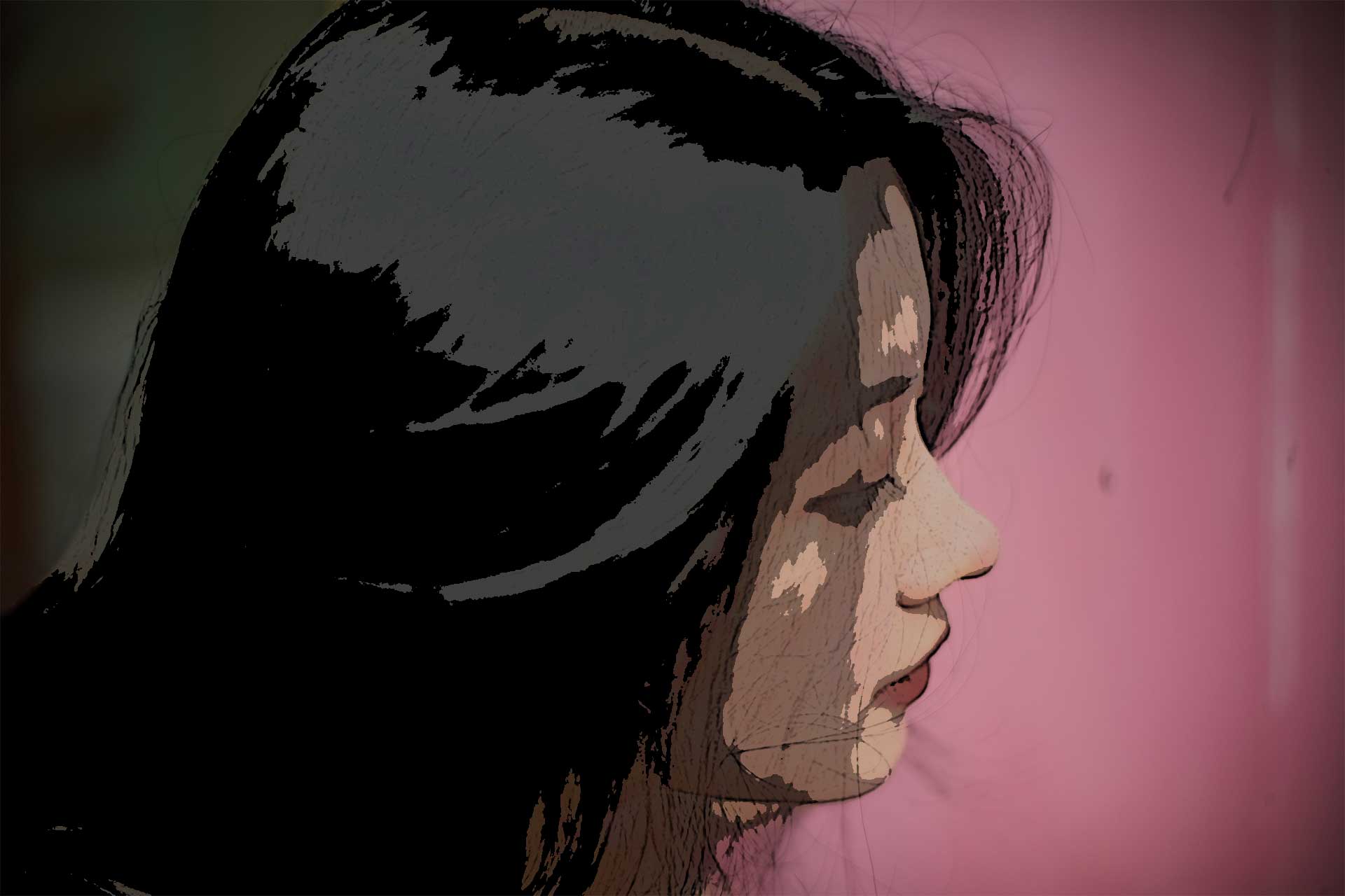 Why Asian Noses Require Different Surgical Techniques