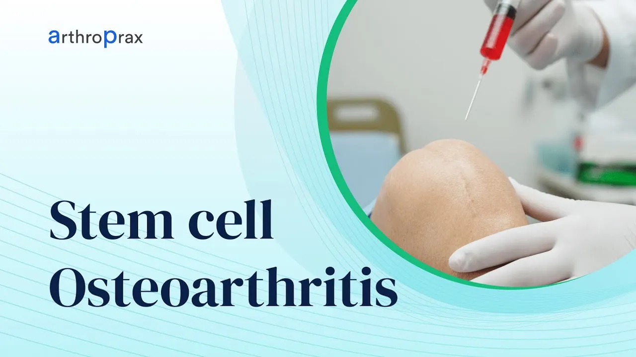 Stem Cell Therapy Osteoarthritis