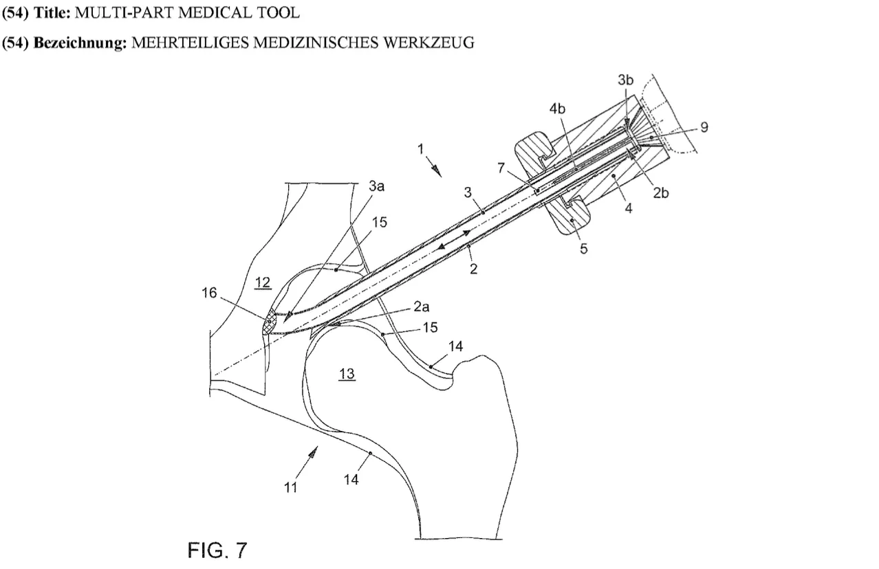 Zeichnung für ein innovatives arthroskopisches Instrument zur regenerativen Knorpeltherapie an Hüfte und Schulter, das nach sechs Jahren Entwicklungszeit erteilt wurde