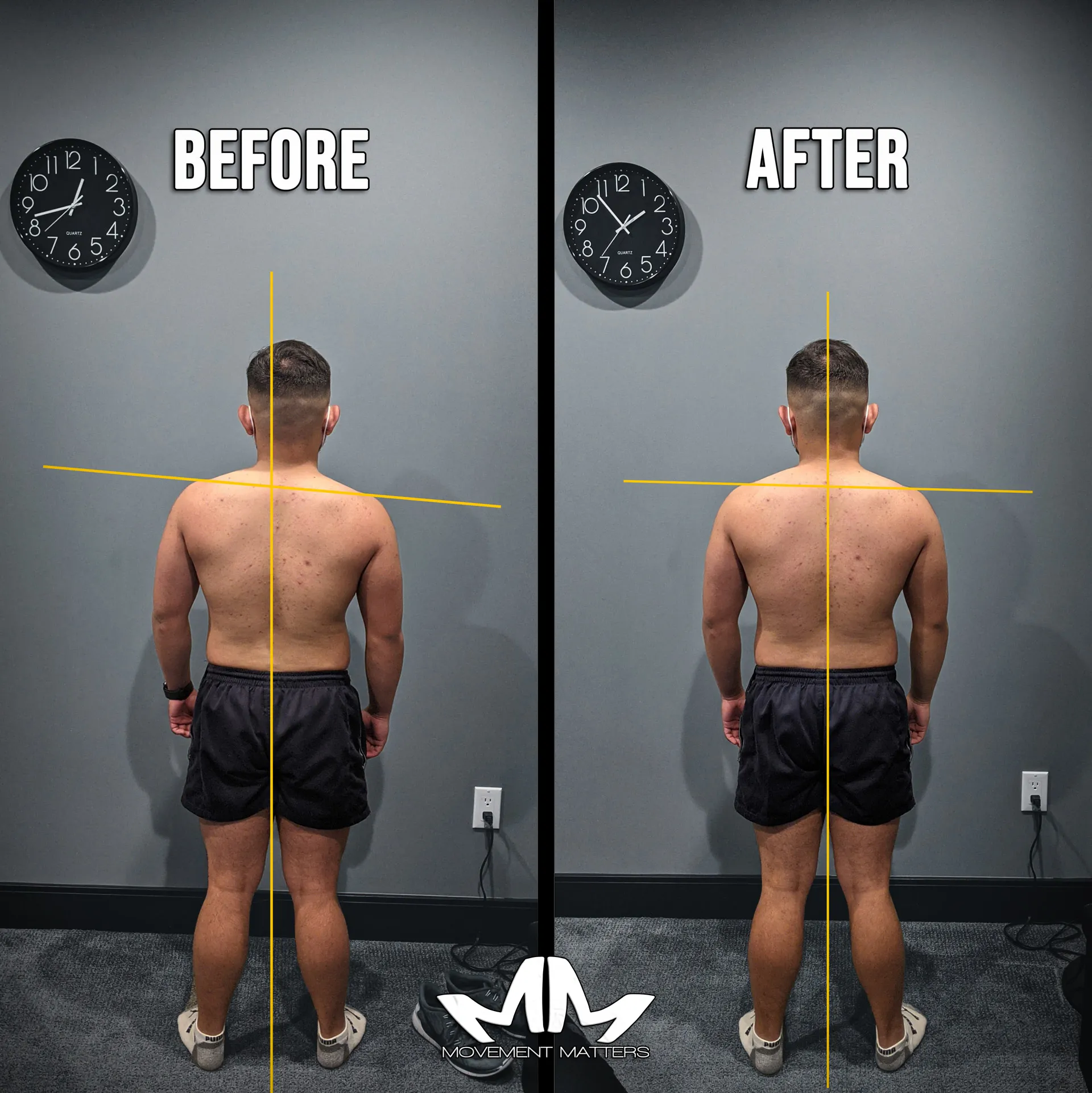Side-by-side posture photos of a past client before and after their first session