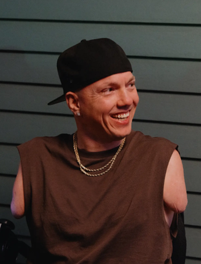 A white man with no arms wearing a backwards ball cap and gold chains smiles while looking to his left.