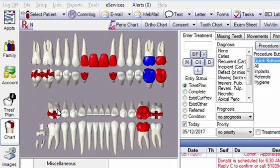 Dental software interface showing upper and lower teeth charts with several teeth highlighted in red and blue to indicate treatment areas and statuses.