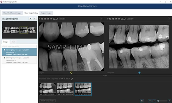 Dental software interface displaying black and white X-ray images of teeth with a patient name and date details.