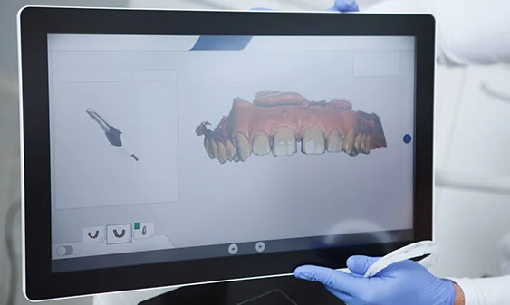 Tablet screen displaying a 3D digital scan of a dental jaw model held by a gloved hand.
