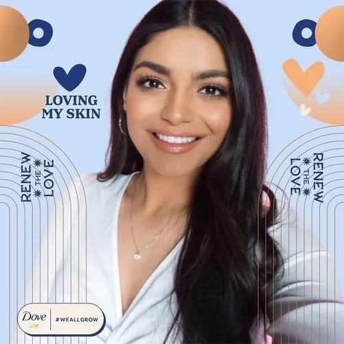 Photo booth snapshot of a guest on a Dove Loving My Skin frame with We All Grow branding