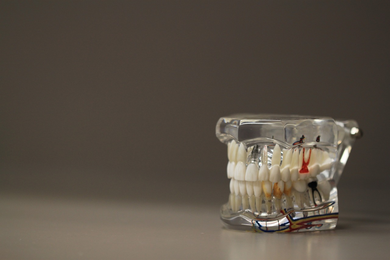 Space Maintainers: Restoring Proper Tooth Alignment in Children
