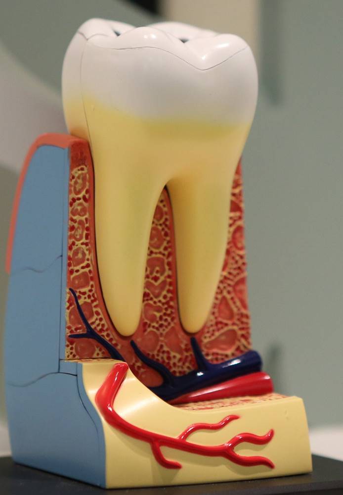 Wisdom Teeth Warning Signs in Teens