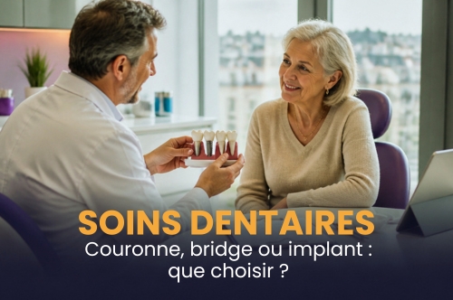 Couronne, bridge ou implant après 60 ans : quelles différences et quels remboursements ?