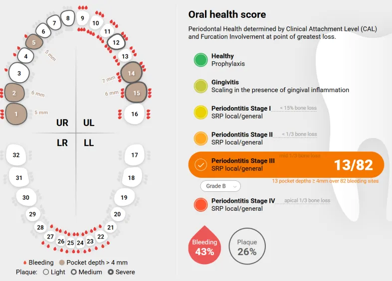 Denti.AI Scribe summary example with amendments