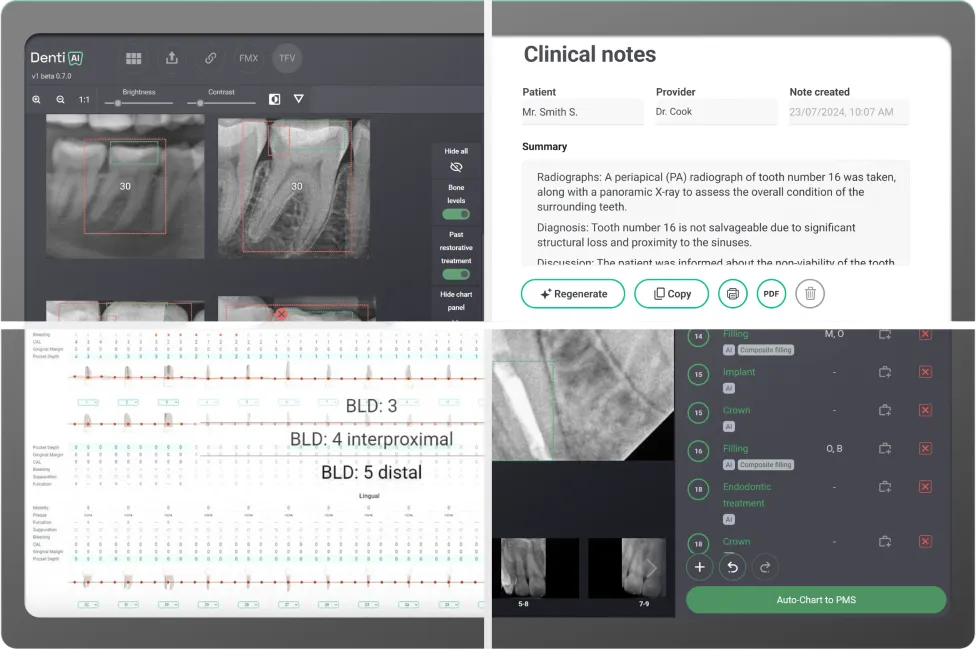 The Denti.AI platform: Denti.AI Detect reading radiographs, Denti.AI Scribe writing the clinical note, Denti.AI Voice Perio charting by voice, and Denti.AI Auto-Chart pushing confirmed findings to the PMS.