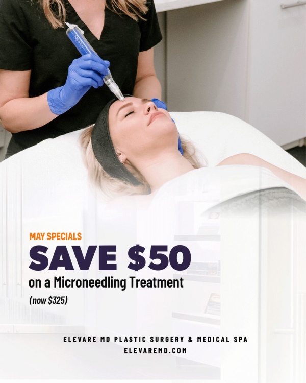 Elevare MD's May Specials