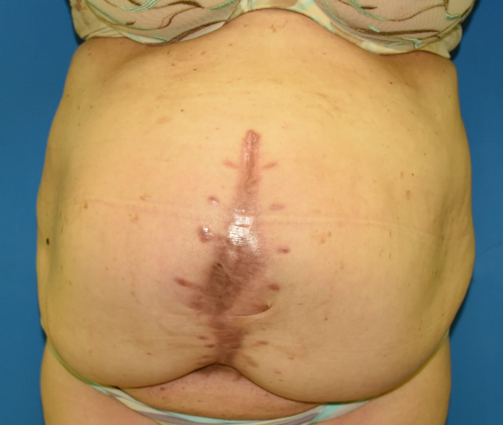 Before surgery image
