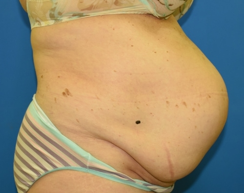 Before surgery image