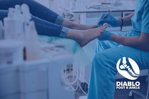 Signs of a Midfoot Sprain | Podiatrist in Walnut Creek, San Ramon, Antioch