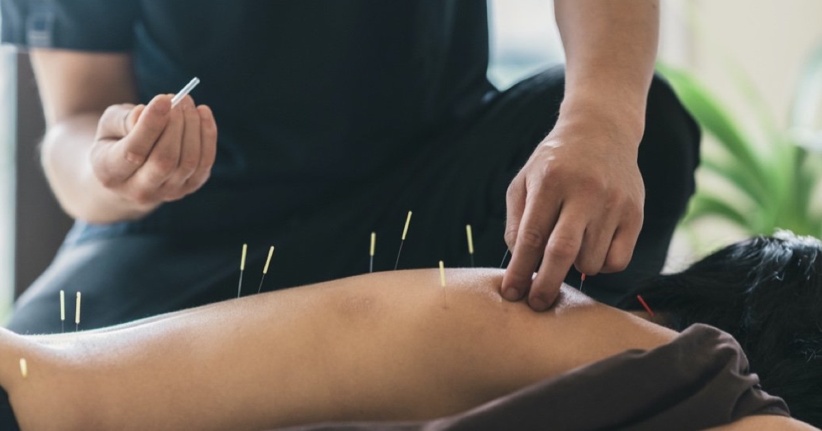 acupuncturist inserting a needle in Currumbin