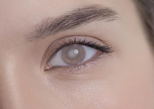 Photo Refractive Keratectomy (PRK)