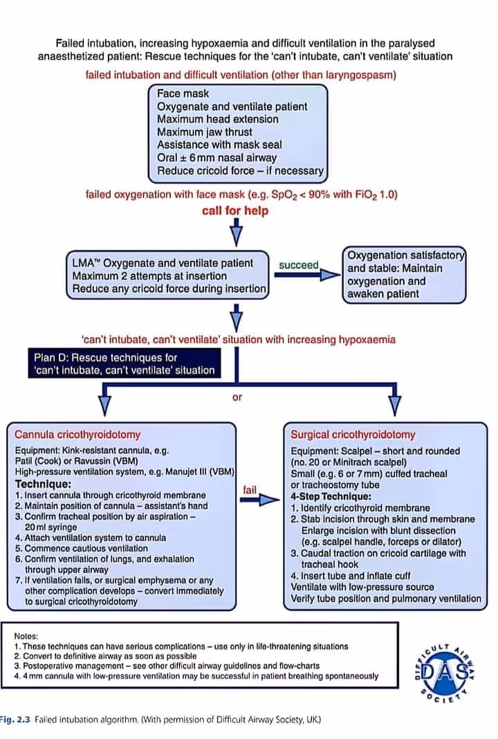 Failed intubation