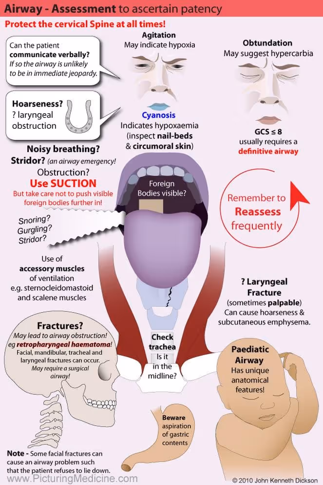 Airway assessment