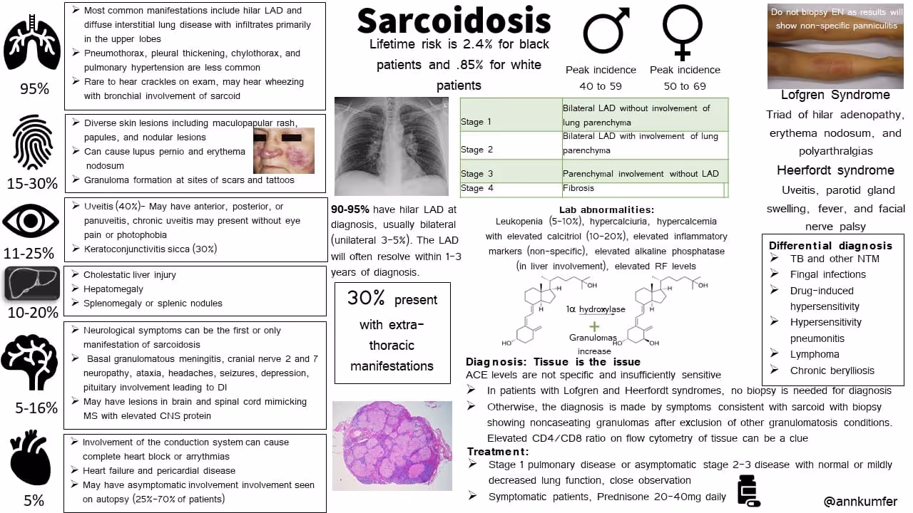 Sarcoidosis