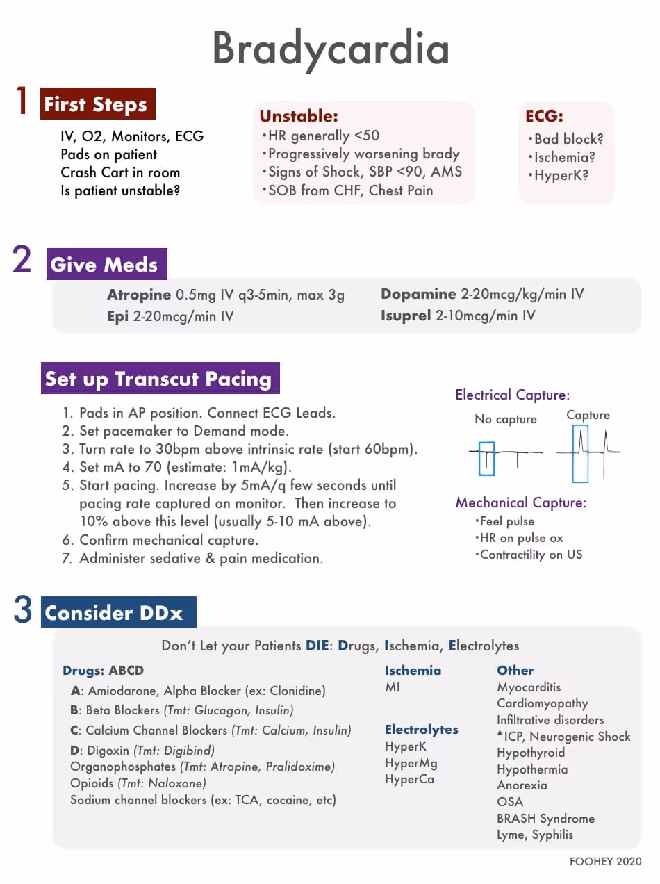 Bradycardia management