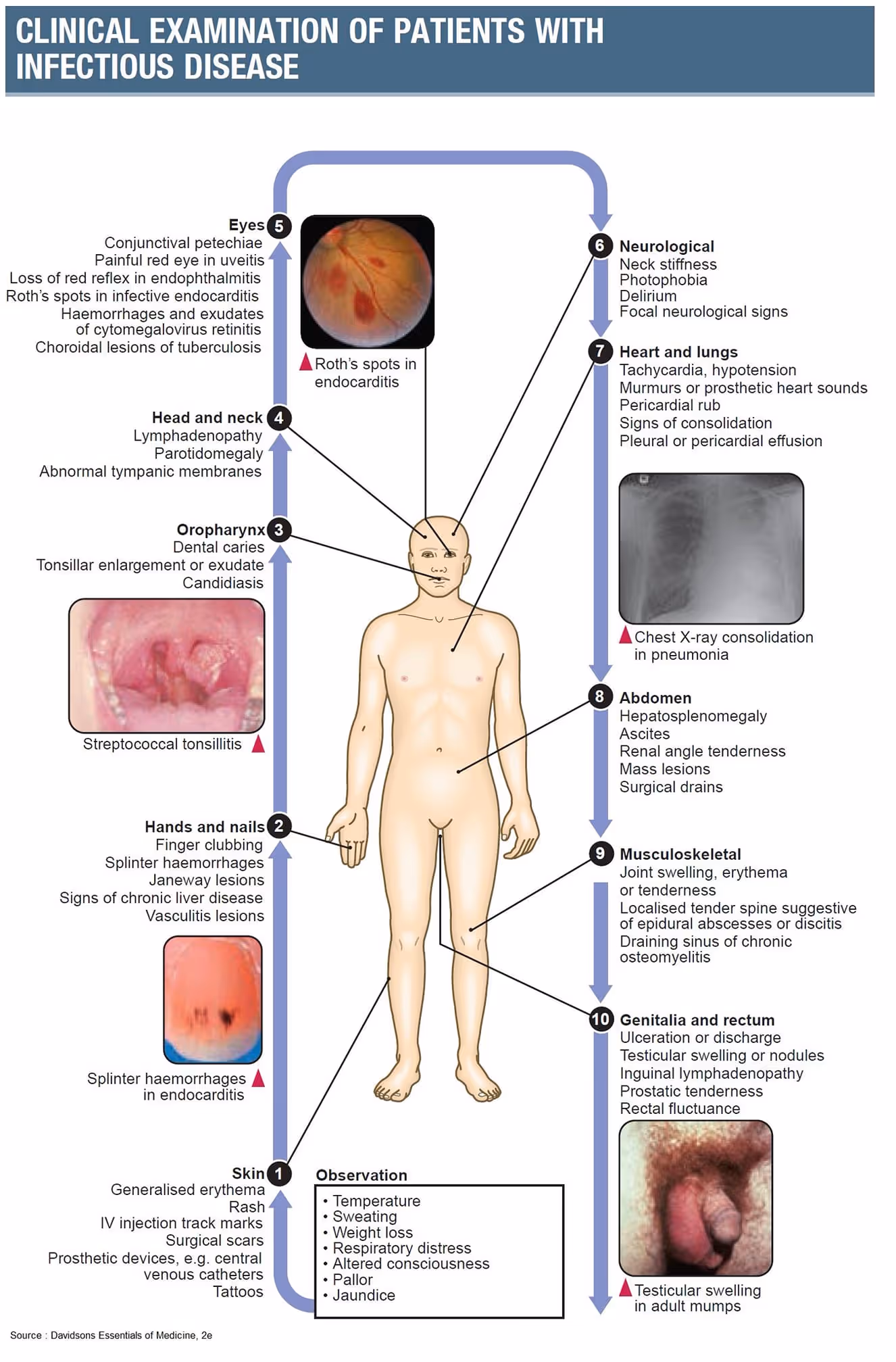 Clinical examination of patients with infectious disease