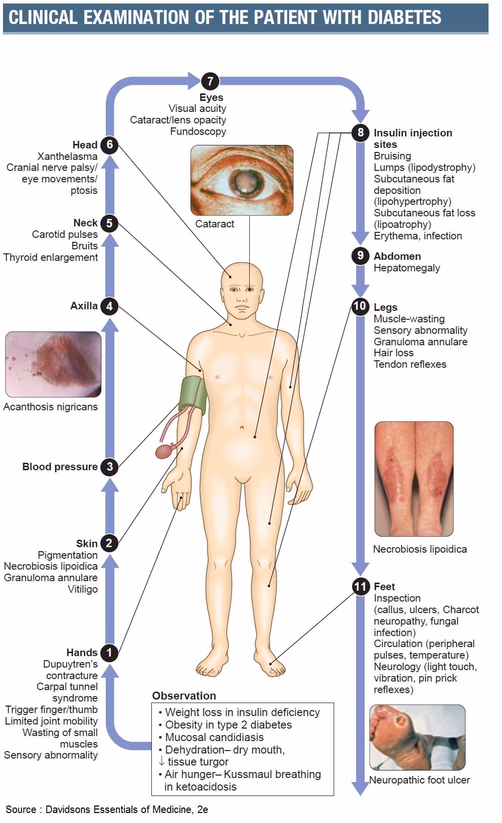 Clinical examination of patients with diabetes
