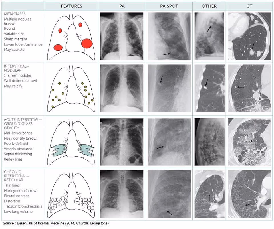 Chest imaging 4