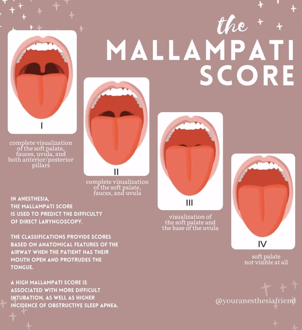 Mallampati score