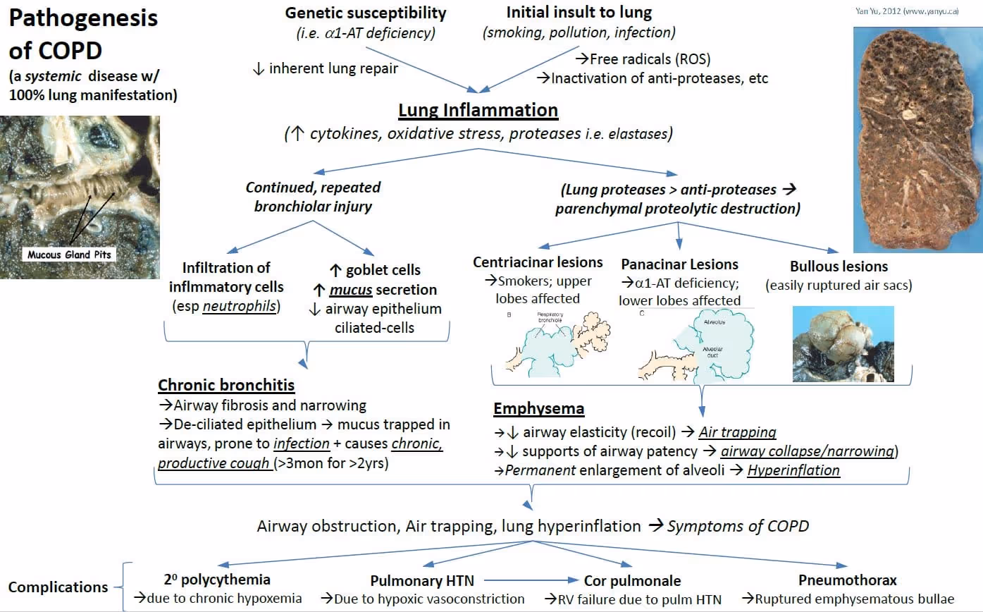 Pathogenesis of COPD