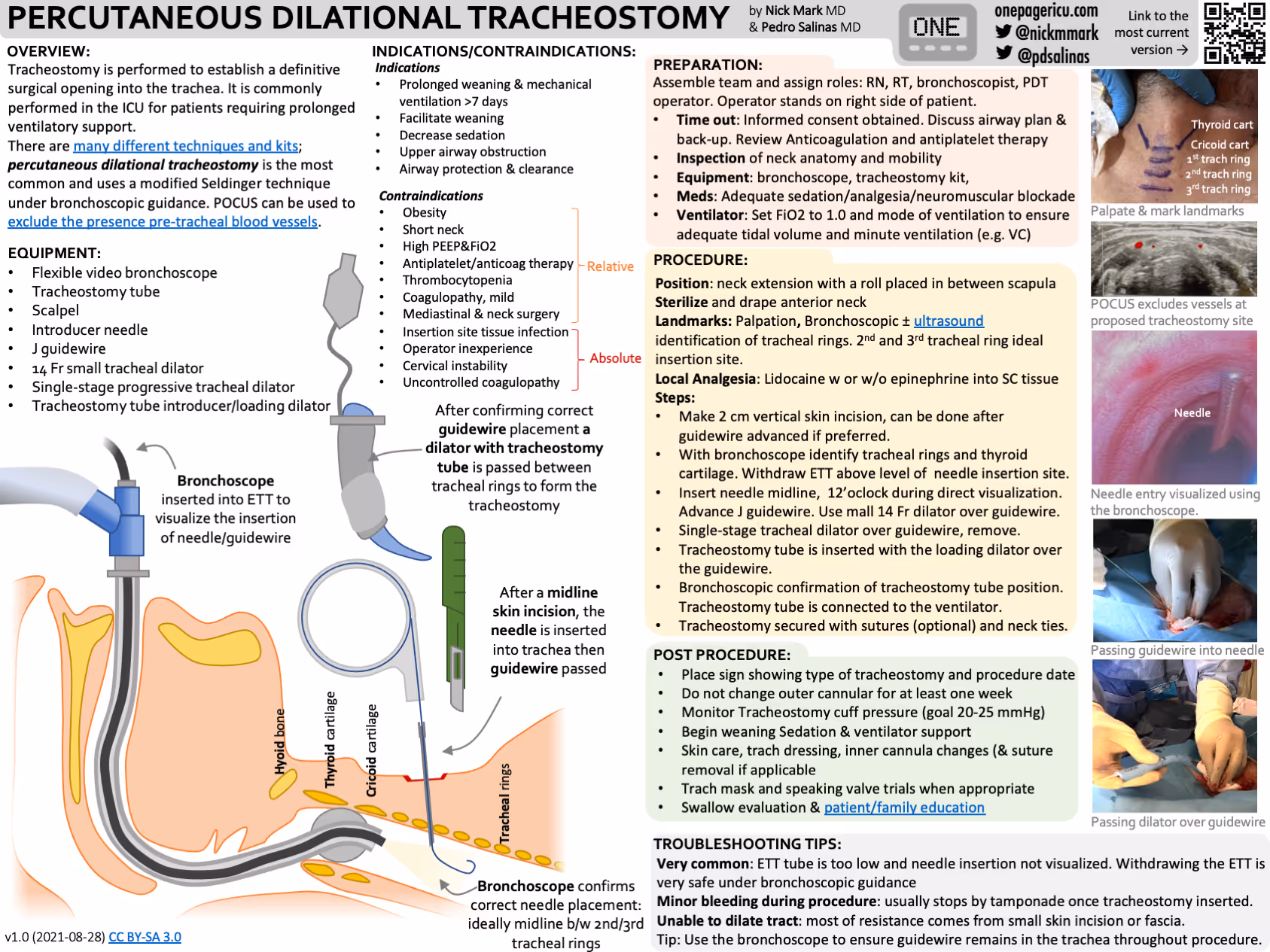 Percutaneous tracheostomy