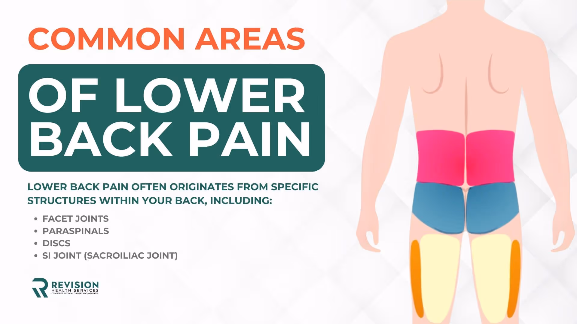 Common Areas of Lower Back Pain