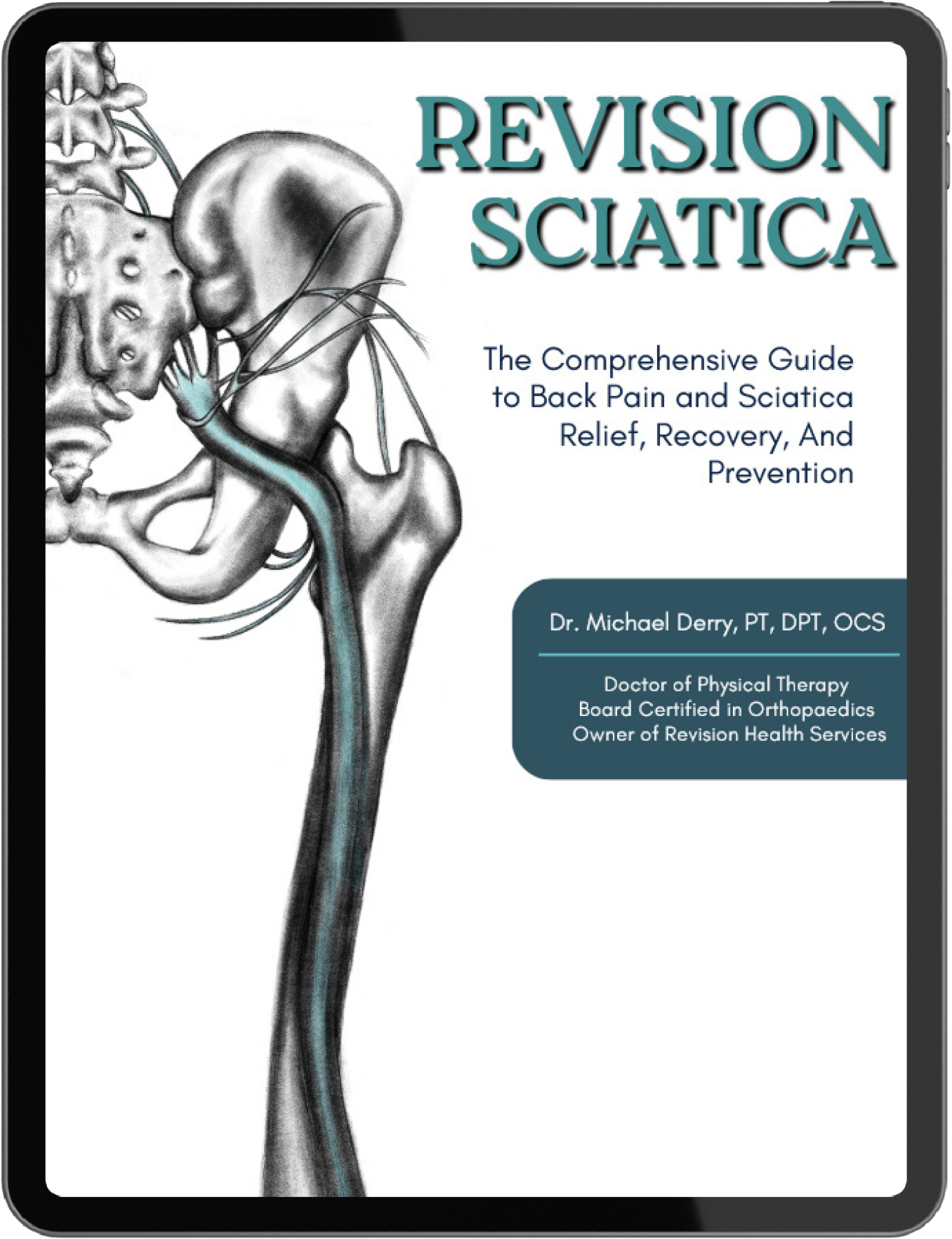Revision Sciatica eBook by Dr. Michael Derry