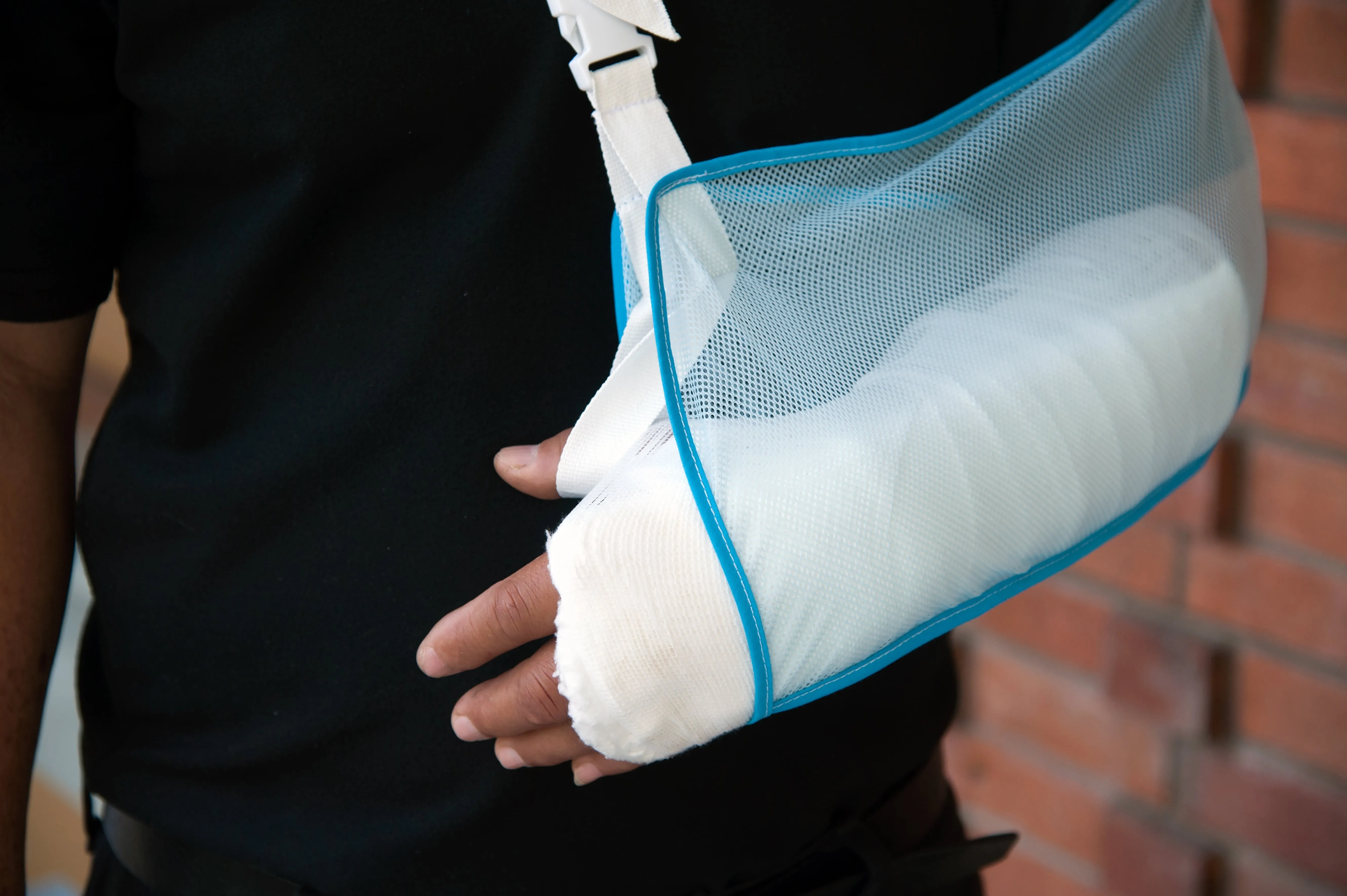 Man with a plaster cast for wrist fracture.