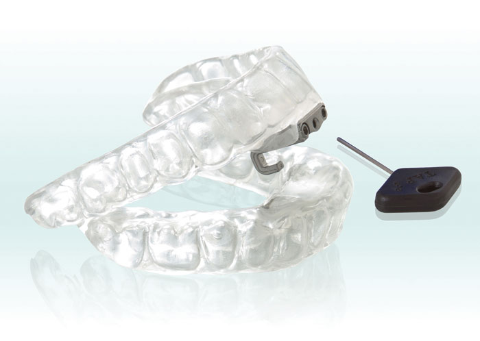 Clear dental night guard with metal clasps and a small black key-like tool on a reflective surface.