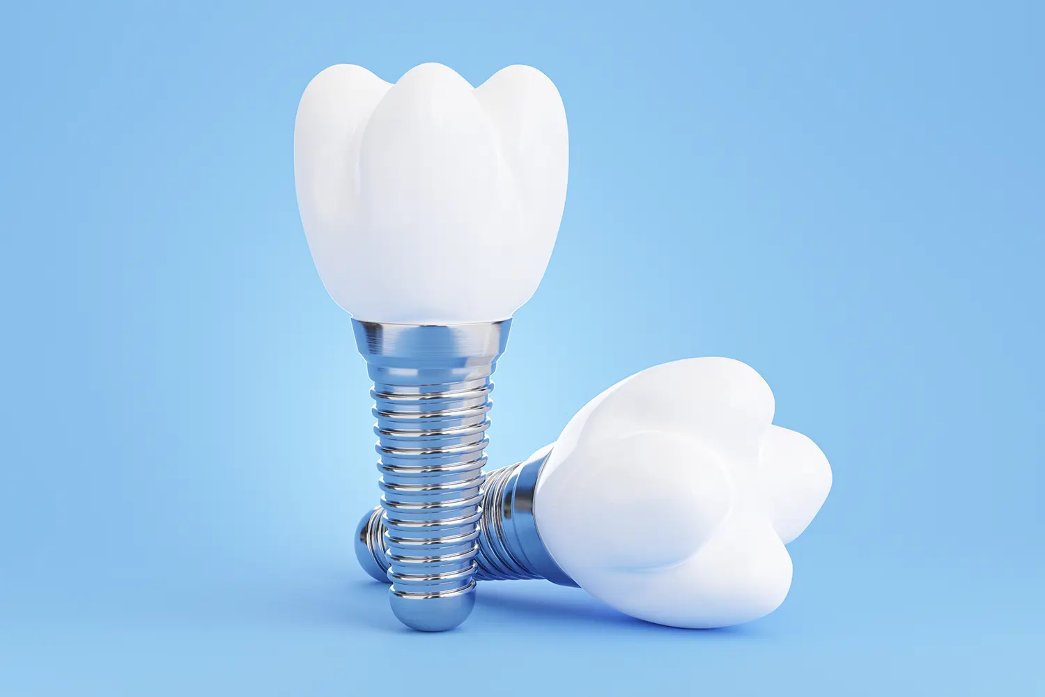 Are You a Good Candidate for Dental Implants?