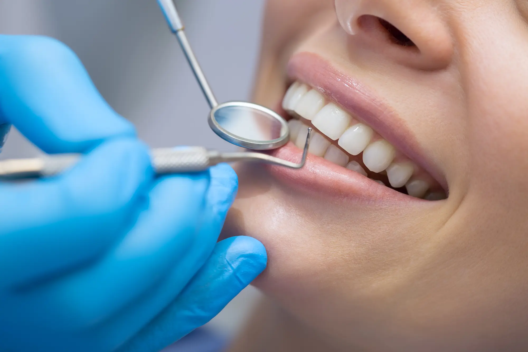 Transforming Smiles: How a Cosmetic Dentist Plans a Full Smile Makeover