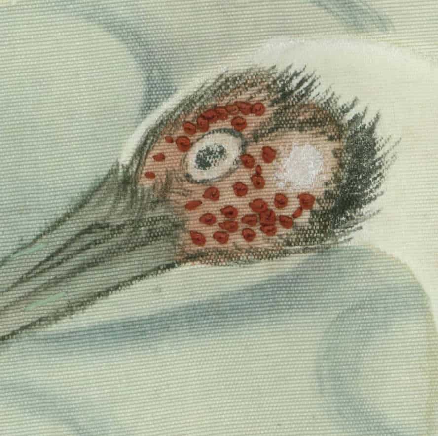 Vintage medical illustration of skin with red circular lesions