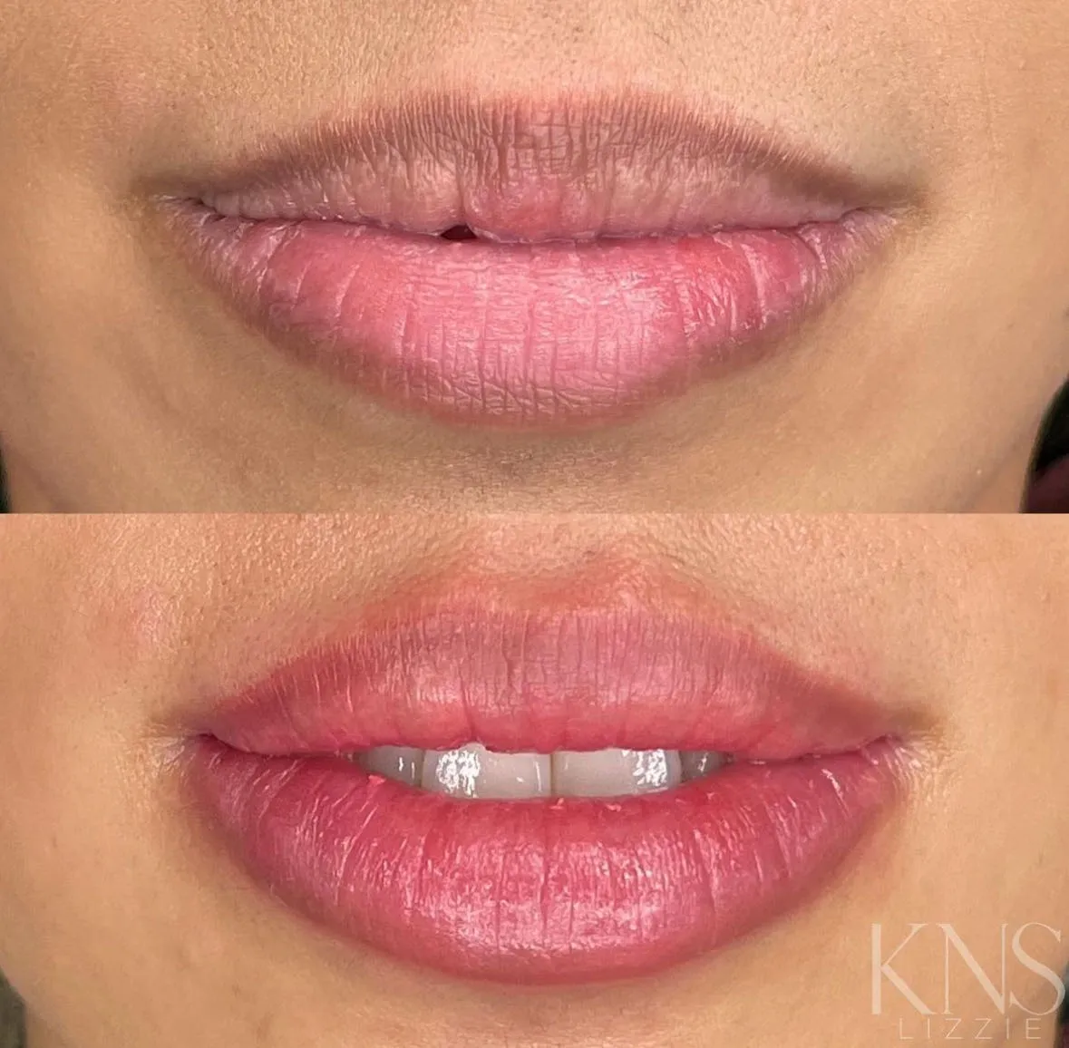 Lip blushing before-and-after for pale lips, with added fullness and definition — healed results at Kendra Neal Studio