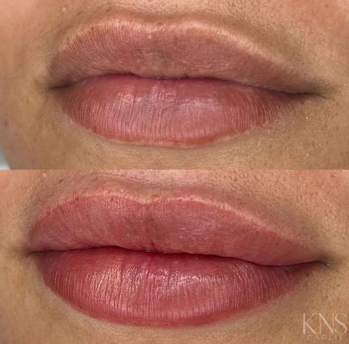 Lip blushing before-and-after with extended, fuller lip corners — healed results at Kendra Neal Studio