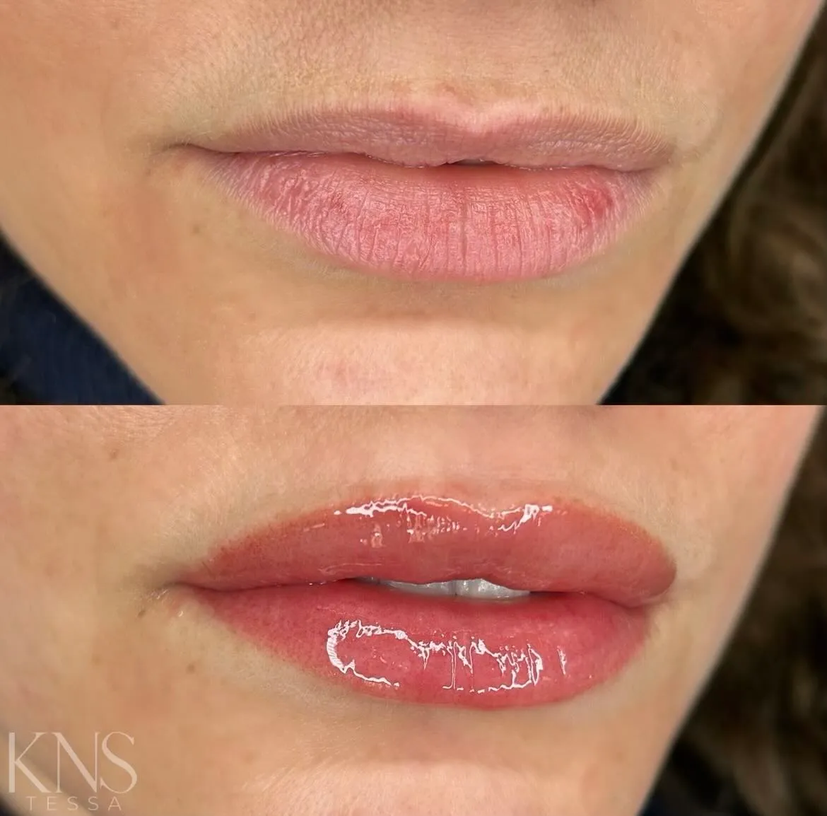 Lip blushing before-and-after for thin lips with added fullness at the corners — healed results at Kendra Neal Studio